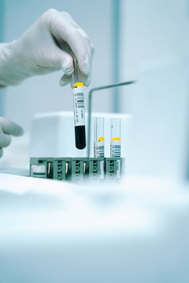 Cold-chain & air freight dominate pharma spend, yet, many procurement teams still manage tenders manually. See why scale hasn't solved the visibility problem...
